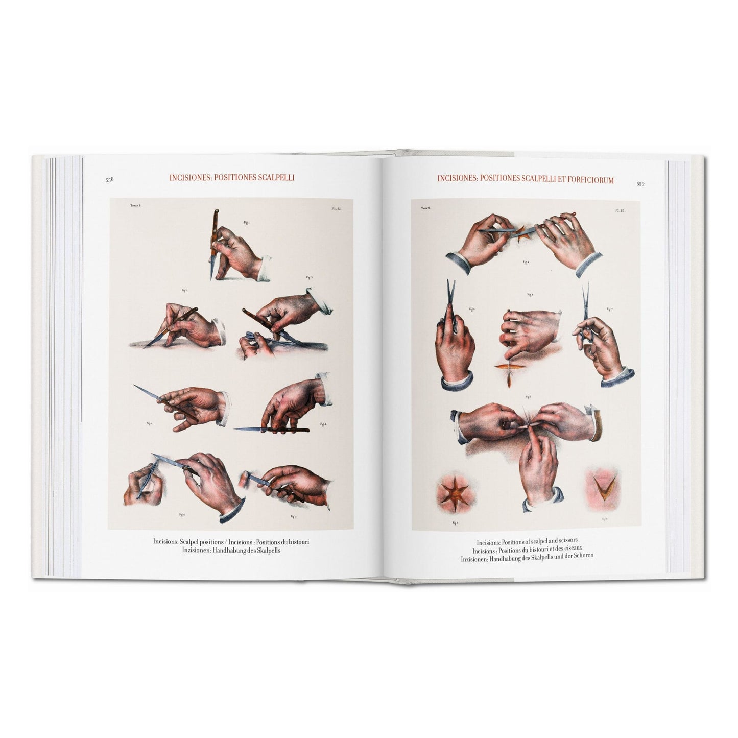 Bourgery. Atlas de anatomía humana y cirugía (Spanish, Italian, Portuguese)